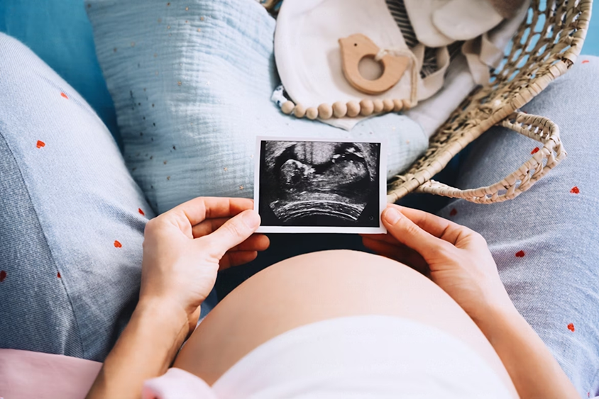 맘스지니 산전케어 마사지